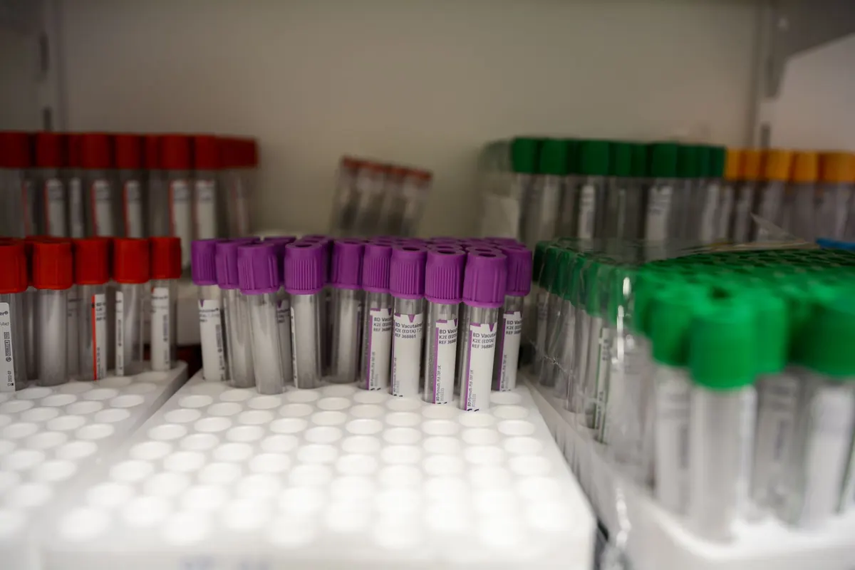 Rows of sealed blood collection tubes with red, purple and green caps in racks in a clean lab