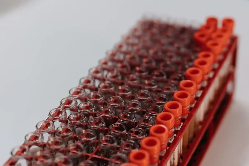 Rack of sealed laboratory sample tubes with orange caps on a white bench
